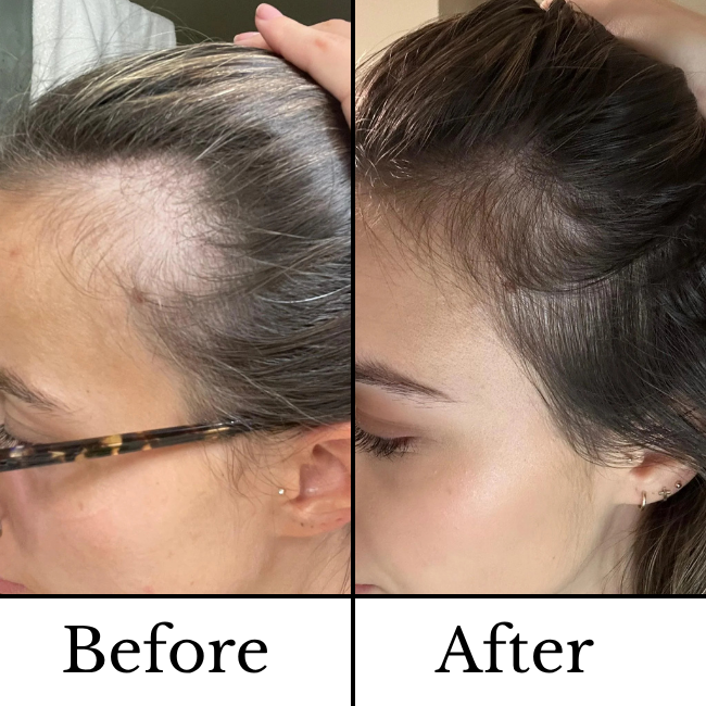 30ml scalp serum