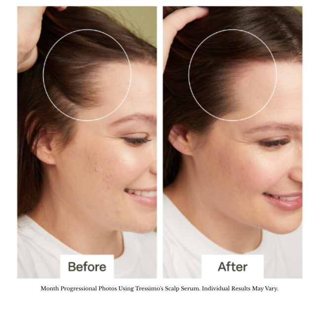 30ml scalp serum