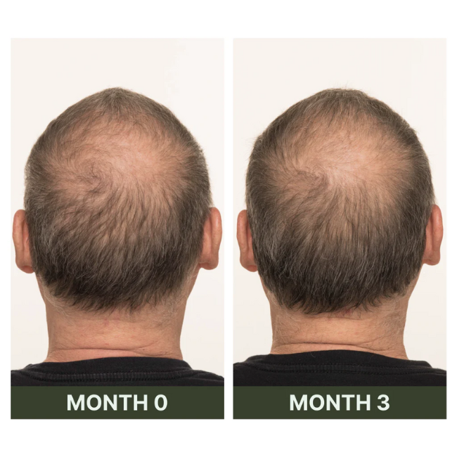 30ml scalp serum